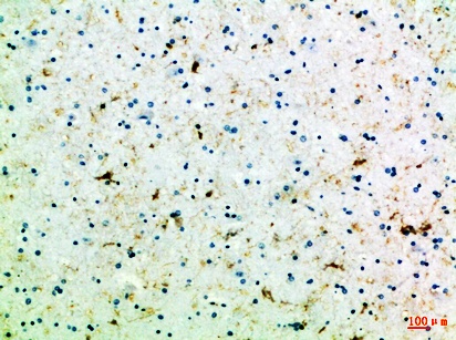Fig.3. Immunohistochemical analysis of paraffin-embedded Human-brain, antibody was diluted at 1:100.