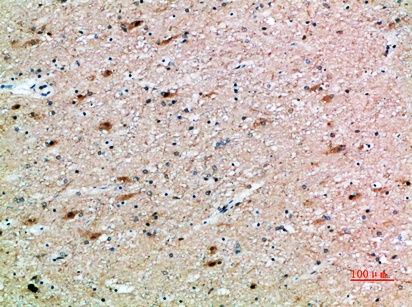 Fig.1. Immunohistochemical analysis of paraffin-embedded human-brain, antibody was diluted at 1:200.
