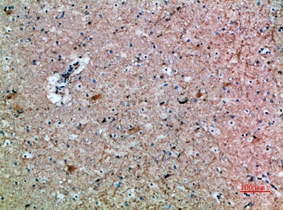 Fig.2. Immunohistochemical analysis of paraffin-embedded human-brain, antibody was diluted at 1:200.
