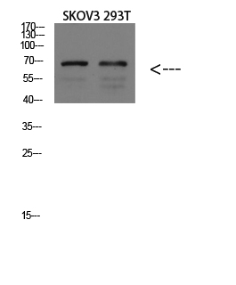 Fig.1. Western blot analysis of Mouse-BRAIN lysate, antibody was diluted at 1:1000. HRP, Goat Anti-Rabbit IgG (Cat #: A21020) secondary antibody was diluted at 1:20000.