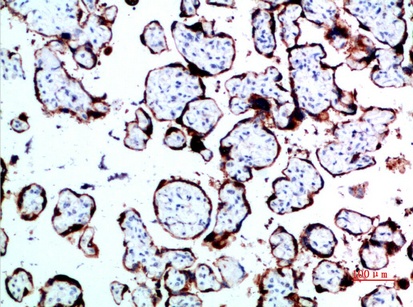 Fig.1. Immunohistochemical analysis of paraffin-embedded human-placenta, antibody was diluted at 1:200.