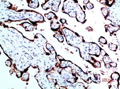 Fig.2. Immunohistochemical analysis of paraffin-embedded human-placenta, antibody was diluted at 1:200.