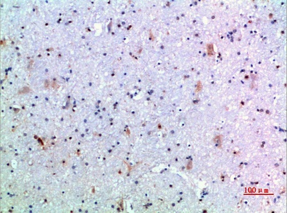 Fig.3. Immunohistochemical analysis of paraffin-embedded human-brain, antibody was diluted at 1:200.