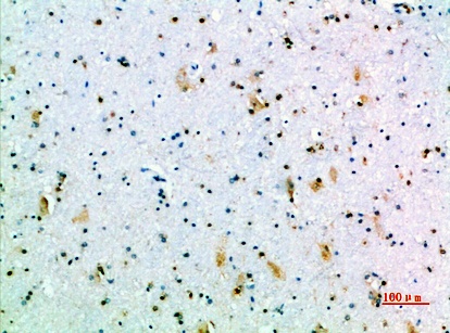 Fig.4. Immunohistochemical analysis of paraffin-embedded human-brain, antibody was diluted at 1:200.
