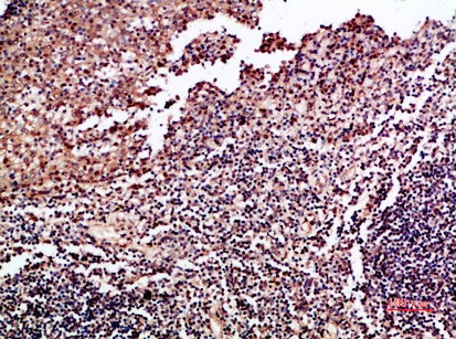 Fig.1. Immunohistochemical analysis of paraffin-embedded human-tonsil, antibody was diluted at 1:200.