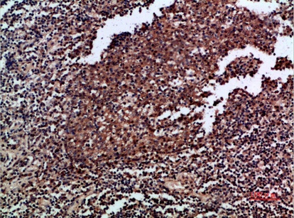 Fig.2. Immunohistochemical analysis of paraffin-embedded human-tonsil, antibody was diluted at 1:200.