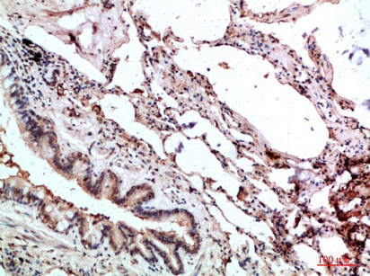Fig.1. Immunohistochemical analysis of paraffin-embedded human-lung, antibody was diluted at 1:200.