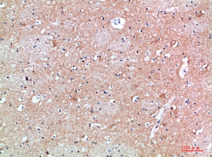 Fig.2. Immunohistochemical analysis of paraffin-embedded human-brain, antibody was diluted at 1:200.