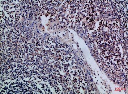 Fig.1. Immunohistochemical analysis of paraffin-embedded Human-tonsil, antibody was diluted at 1:100.