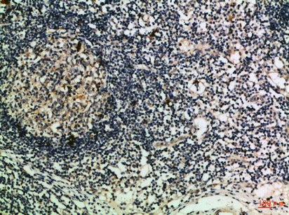 Fig.2. Immunohistochemical analysis of paraffin-embedded Human-lymph, antibody was diluted at 1:100.