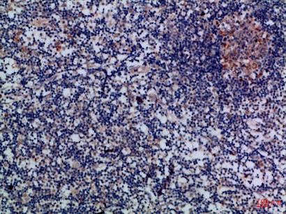 Fig.3. Immunohistochemical analysis of paraffin-embedded Human-lymph, antibody was diluted at 1:100.