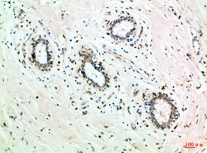 Fig.1. Immunohistochemical analysis of paraffin-embedded Human-breast, antibody was diluted at 1:100.