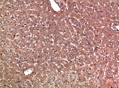 Fig.1. Immunohistochemical analysis of paraffin-embedded Human-liver, antibody was diluted at 1:100.