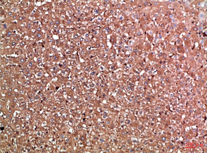 Fig.2. Immunohistochemical analysis of paraffin-embedded Human-liver, antibody was diluted at 1:100.