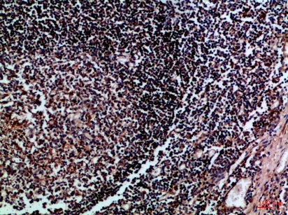 Fig.1. Immunohistochemical analysis of paraffin-embedded Human-tonsil, antibody was diluted at 1:100.