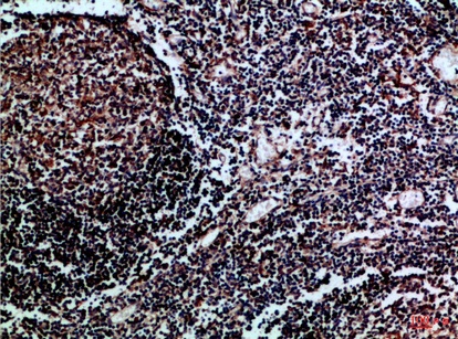 Fig.2. Immunohistochemical analysis of paraffin-embedded Human-tonsil, antibody was diluted at 1:100.