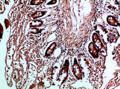 Fig.3. Immunohistochemical analysis of paraffin-embedded Human-colon, antibody was diluted at 1:100.
