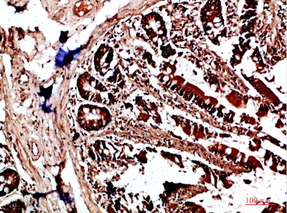 Fig.2. Immunohistochemical analysis of paraffin-embedded human-colon, antibody was diluted at 1:200.