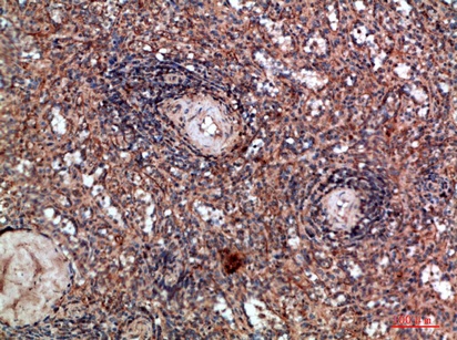 Fig.3. Immunohistochemical analysis of paraffin-embedded human-spleen, antibody was diluted at 1:200.