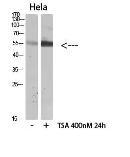 Fig.1. Western blot analysis of Mouse-lung Mouse-kidney Mouse-liver lysate, antibody was diluted at 1:500. HRP, Goat Anti-Rabbit IgG (Cat #: A21020) secondary antibody was diluted at 1:20000.