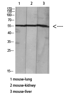 Fig.1. Western blot analysis of Mouse-lung Mouse-brain Mouse-heart Hela Mouse-liver lysate, antibody was diluted at 1:500. HRP, Goat Anti-Rabbit IgG (Cat #: A21020) secondary antibody was diluted at 1:20000.