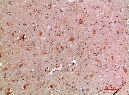 Fig.3. Immunohistochemical analysis of paraffin-embedded human-brain, antibody was diluted at 1:200.