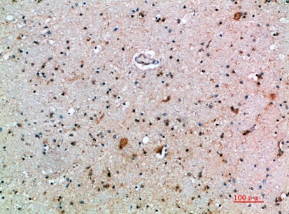 Fig.4. Immunohistochemical analysis of paraffin-embedded human-brain, antibody was diluted at 1:200.