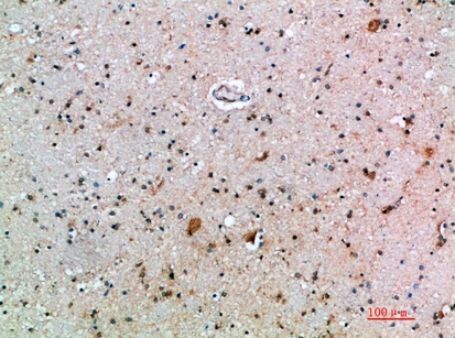 Fig.4. Immunohistochemical analysis of paraffin-embedded human-brain, antibody was diluted at 1:200.