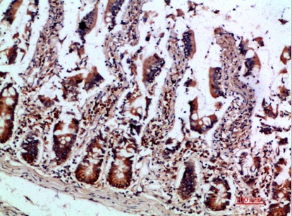 Fig.3. Immunohistochemical analysis of paraffin-embedded human-colon, antibody was diluted at 1:200.