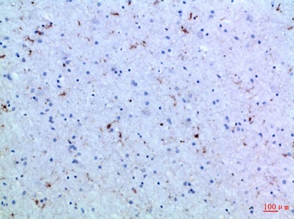 Fig.3. Immunohistochemical analysis of paraffin-embedded Human-brain, antibody was diluted at 1:100.