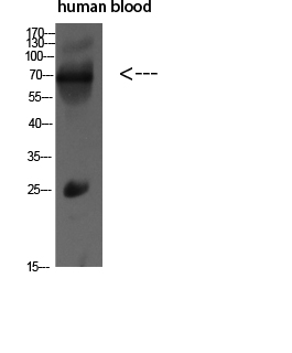 Fig.1. Western blot analysis of MCF7 SW480 Mouse-LIVER Mouse-lung Mouse-KIDNEY lysate, antibody was diluted at 1:500. HRP, Goat Anti-Rabbit IgG (Cat #: A21020) secondary antibody was diluted at 1:20000.