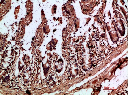 Fig.2. Immunohistochemical analysis of paraffin-embedded human-colon, antibody was diluted at 1:200.