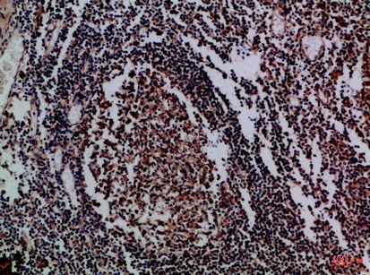 Fig.1. Immunohistochemical analysis of paraffin-embedded Human-tonsil, antibody was diluted at 1:100.