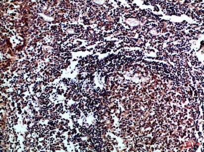Fig.2. Immunohistochemical analysis of paraffin-embedded Human-tonsil, antibody was diluted at 1:100.