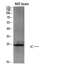 Fig.1. Western blot analysis of 293T Hela VEC KB Mouse-kidney lysate, antibody was diluted at 1:500. HRP, Goat Anti-Rabbit IgG (Cat #: A21020) secondary antibody was diluted at 1:20000.