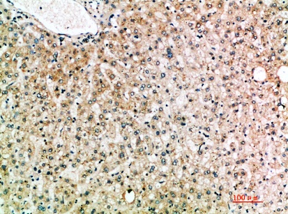 Fig.2. Immunohistochemical analysis of paraffin-embedded human-liver, antibody was diluted at 1:200.