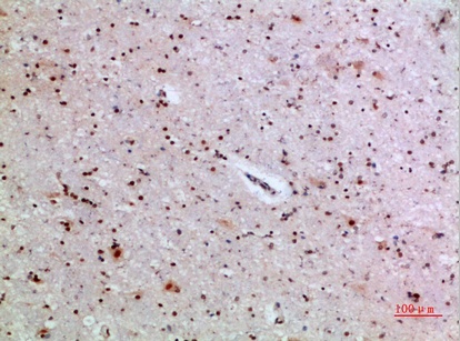 Fig.1. Immunohistochemical analysis of paraffin-embedded human-brain, antibody was diluted at 1:200.