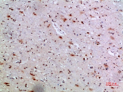 Fig.2. Immunohistochemical analysis of paraffin-embedded human-brain, antibody was diluted at 1:200.