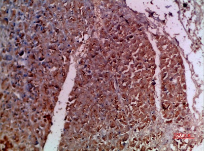Fig.1. Immunohistochemical analysis of paraffin-embedded human-pancreas, antibody was diluted at 1:200.