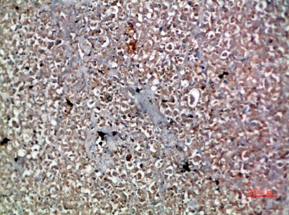 Fig.2. Immunohistochemical analysis of paraffin-embedded human-pancreas, antibody was diluted at 1:200.