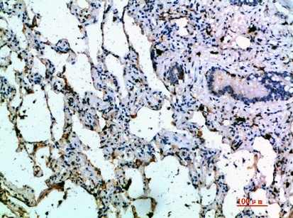 Fig.1. Immunohistochemical analysis of paraffin-embedded human-lung, antibody was diluted at 1:200.