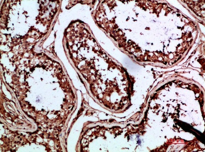 Fig.1. Immunohistochemical analysis of paraffin-embedded human-testis, antibody was diluted at 1:200.