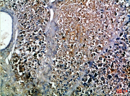 Fig.1. Immunohistochemical analysis of paraffin-embedded Human-pancreas, antibody was diluted at 1:100.