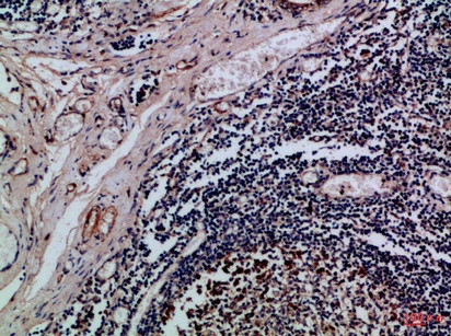 Fig.1. Immunohistochemical analysis of paraffin-embedded Human-tonsil, antibody was diluted at 1:100.