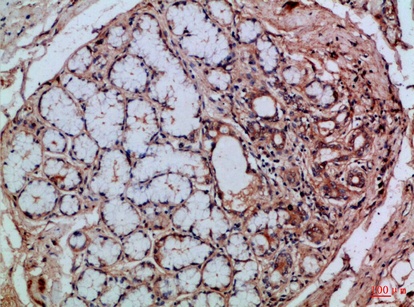 Fig.2. Immunohistochemical analysis of paraffin-embedded Human-tonsil, antibody was diluted at 1:100.
