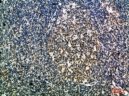 Fig.1. Immunohistochemical analysis of paraffin-embedded human-tonsil, antibody was diluted at 1:200.