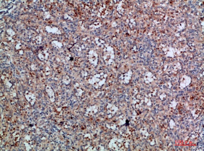 Fig.2. Immunohistochemical analysis of paraffin-embedded human-spleen, antibody was diluted at 1:200.