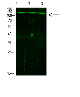 Fig.1. Western Blot analysis of 1, Mouse-liver 2, hela 3,Mouse-brain cells using primary antibody diluted at 1:1000 (4°C overnight). Goat Anti-rabbit IgG Dylight 800 (Cat #: A23920) secondary antibody was diluted at 1:5000 at 25°C for 1 hour.