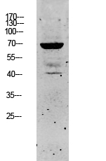 Fig.1. Western blot analysis of SW480 lysate, antibody was diluted at 1:1000. HRP, Goat Anti-Rabbit IgG (Cat #: A21020) secondary antibody was diluted at 1:20000.