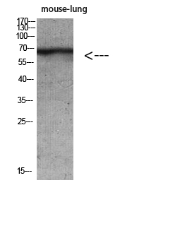 Fig.1. Western blot analysis of Mouse-lung Mouse-brain Mouse-kidney Mouse-heart lysate, antibody was diluted at 1:500. HRP, Goat Anti-Rabbit IgG (Cat #: A21020) secondary antibody was diluted at 1:20000.